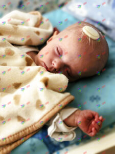 Юстина протистоїть рідкісній хворобі