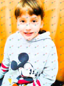 Spina bifida забирає кроки